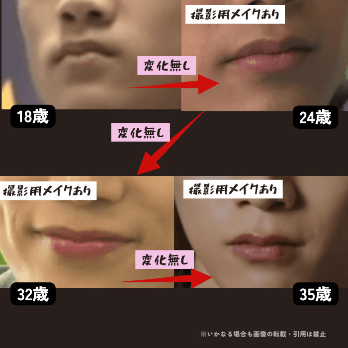 韓国アイドル2PMのメンバー、オク・テギョンの唇の変化について時系列検証画像
以下4枚の画像

18歳（左上画像）
24歳（右上画像）撮影用メイクあり
32歳（左下画像）撮影用メイクあり
35歳（右下画像）撮影用メイクあり

撮影用リップをしっかり塗るタイプだが、唇の形に変化無し